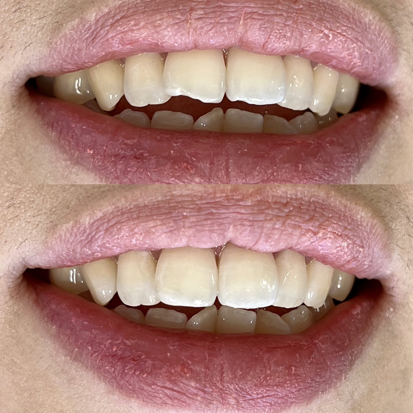 Before and after