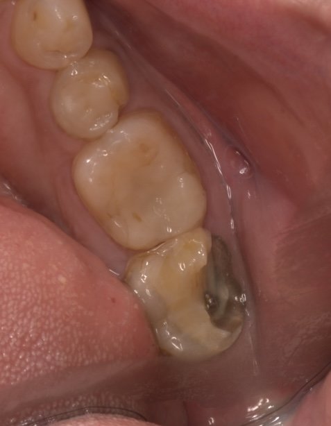 Before treatment