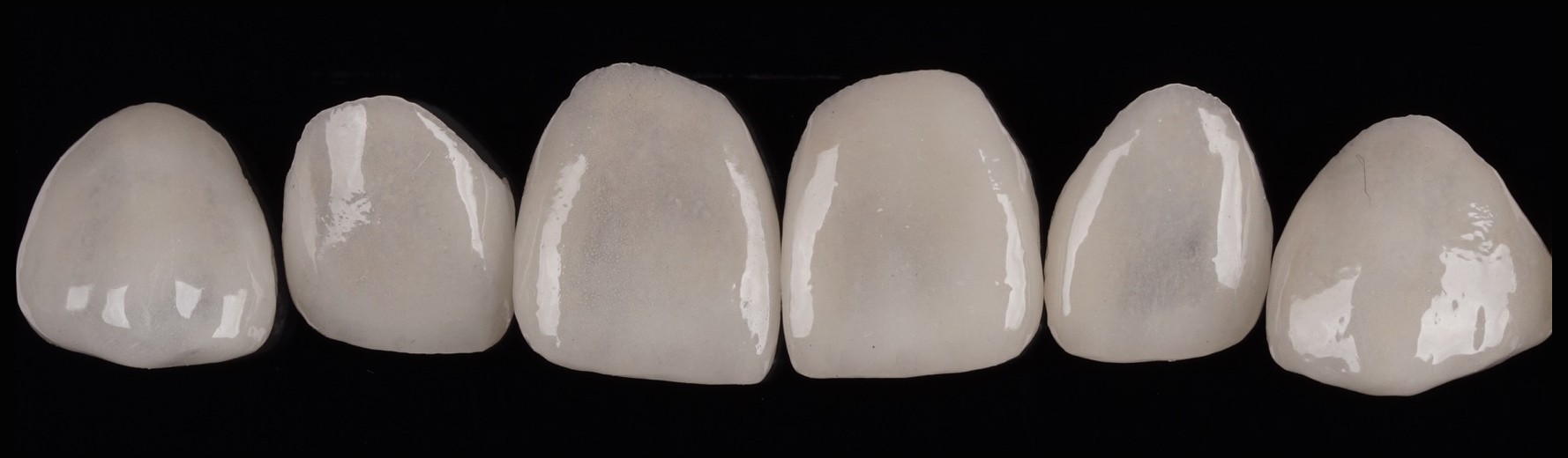 A row of porcelain veneers from the laboratory, before placement
