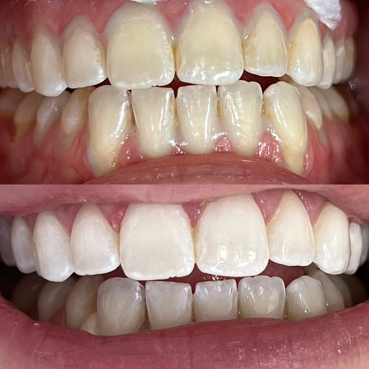 Before and after